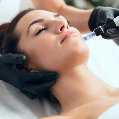 clinique soin visage microneedling à nancy et à metz