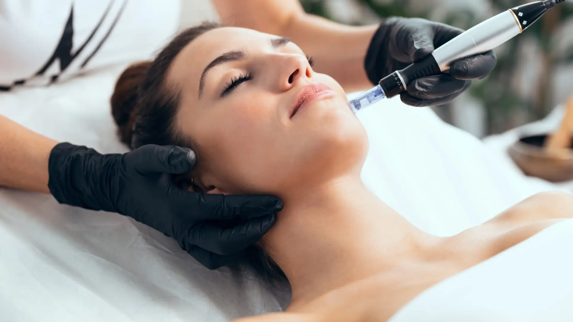 clinique soin visage microneedling à nancy et à metz
